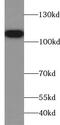 Trophinin Associated Protein antibody, FNab09011, FineTest, Western Blot image 