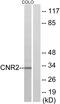 Cannabinoid Receptor 2 antibody, LS-B9270, Lifespan Biosciences, Western Blot image 