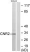 rCB2 antibody, LS-B9270, Lifespan Biosciences, Western Blot image 