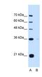 Torsin Family 1 Member B antibody, NBP1-62568, Novus Biologicals, Western Blot image 