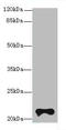 Transmembrane Protein 154 antibody, A63592-100, Epigentek, Western Blot image 