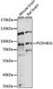 Protocadherin Beta 16 antibody, 16-072, ProSci, Western Blot image 