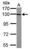 ACK1 antibody, GTX106229, GeneTex, Western Blot image 