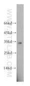 Eukaryotic Translation Initiation Factor 2B Subunit Alpha antibody, 18010-1-AP, Proteintech Group, Western Blot image 