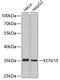 Potassium Voltage-Gated Channel Subfamily J Member 15 antibody, 19-220, ProSci, Western Blot image 