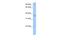 Acid Phosphatase 4 antibody, A13090, Boster Biological Technology, Western Blot image 