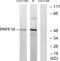 Pre-MRNA Processing Factor 19 antibody, LS-B9675, Lifespan Biosciences, Western Blot image 