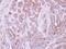 TEK Receptor Tyrosine Kinase antibody, PA5-28582, Invitrogen Antibodies, Immunohistochemistry paraffin image 