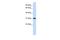 Carbonic Anhydrase 8 antibody, PA5-42120, Invitrogen Antibodies, Western Blot image 