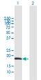 Odontogenic, Ameloblast Associated antibody, H00054959-B01P, Novus Biologicals, Western Blot image 