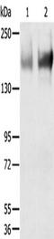 Transient Receptor Potential Cation Channel Subfamily M Member 6 antibody, TA351859, Origene, Western Blot image 