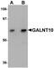 Polypeptide N-Acetylgalactosaminyltransferase 10 antibody, NBP1-77058, Novus Biologicals, Western Blot image 