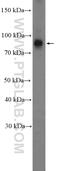 Nucleoporin 93 antibody, 13077-1-AP, Proteintech Group, Western Blot image 