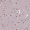 Aprataxin antibody, HPA064930, Atlas Antibodies, Immunohistochemistry paraffin image 