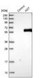 Angiotensinogen antibody, NBP1-87053, Novus Biologicals, Western Blot image 