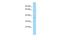 Pleckstrin Homology Domain Containing A3 antibody, A10563, Boster Biological Technology, Western Blot image 
