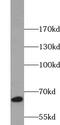 Solute Carrier Family 18 Member A2 antibody, FNab09418, FineTest, Western Blot image 