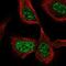 Cell Division Cycle 25C antibody, NBP2-57705, Novus Biologicals, Immunocytochemistry image 