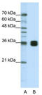 Heterogeneous Nuclear Ribonucleoprotein A0 antibody, TA345987, Origene, Western Blot image 