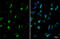 Polypeptide N-Acetylgalactosaminyltransferase 3 antibody, GTX131628, GeneTex, Immunocytochemistry image 