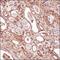 Tensin 1 antibody, NBP2-78783, Novus Biologicals, Immunohistochemistry paraffin image 