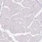 CCCTC-Binding Factor Like antibody, PA5-51584, Invitrogen Antibodies, Immunohistochemistry paraffin image 