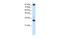 CCCTC-Binding Factor antibody, PA5-46847, Invitrogen Antibodies, Western Blot image 