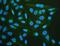 Acetylcholine Receptor antibody, LS-C313301, Lifespan Biosciences, Immunofluorescence image 