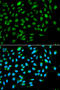 Inhibitor Of Growth Family Member 3 antibody, STJ28395, St John