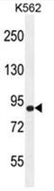 ArfGAP With GTPase Domain, Ankyrin Repeat And PH Domain 9 antibody, AP50108PU-N, Origene, Western Blot image 