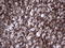 Thyroglobulin antibody, LS-C339174, Lifespan Biosciences, Immunohistochemistry paraffin image 