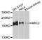 Mannose Receptor C Type 2 antibody, A9858, ABclonal Technology, Western Blot image 