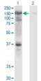 Ubiquitin Specific Peptidase 4 antibody, H00007375-M01, Novus Biologicals, Western Blot image 