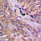 Protein Kinase AMP-Activated Catalytic Subunit Alpha 1 antibody, LS-C354066, Lifespan Biosciences, Immunohistochemistry paraffin image 