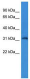 Potassium Voltage-Gated Channel Interacting Protein 4 antibody, TA337975, Origene, Western Blot image 