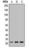 Lipocalin 2 antibody, LS-C667939, Lifespan Biosciences, Western Blot image 