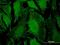 Protein Phosphatase 2 Regulatory Subunit B'Delta antibody, H00005528-M21, Novus Biologicals, Immunofluorescence image 