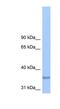 Phospholipid Phosphatase Related 2 antibody, NBP1-62301, Novus Biologicals, Western Blot image 