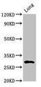Synaptoporin antibody, CSB-PA023023LA01HU, Cusabio, Western Blot image 