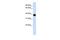 Delta 4-Desaturase, Sphingolipid 1 antibody, GTX46544, GeneTex, Western Blot image 