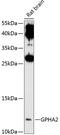 Glycoprotein Hormone Subunit Alpha 2 antibody, 13-754, ProSci, Western Blot image 