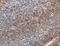 Integrin Subunit Beta 1 antibody, LS-C400827, Lifespan Biosciences, Immunohistochemistry paraffin image 