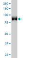 Tousled Like Kinase 1 antibody, LS-C133607, Lifespan Biosciences, Western Blot image 