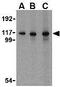 Interferon Induced With Helicase C Domain 1 antibody, GTX31304, GeneTex, Western Blot image 