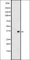 Interleukin 17B antibody, orb337775, Biorbyt, Western Blot image 