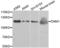 Dynamin 1 antibody, LS-C332283, Lifespan Biosciences, Western Blot image 