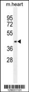 Adaptor Related Protein Complex 1 Subunit Mu 1 antibody, 55-800, ProSci, Western Blot image 