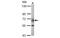 Polypeptide N-Acetylgalactosaminyltransferase 2 antibody, MBS837450, MyBioSource, Western Blot image 