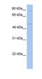 Transmembrane And Tetratricopeptide Repeat Containing 2 antibody, orb325438, Biorbyt, Western Blot image 