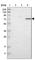 TATA-Box Binding Protein Associated Factor 6 antibody, HPA006566, Atlas Antibodies, Western Blot image 